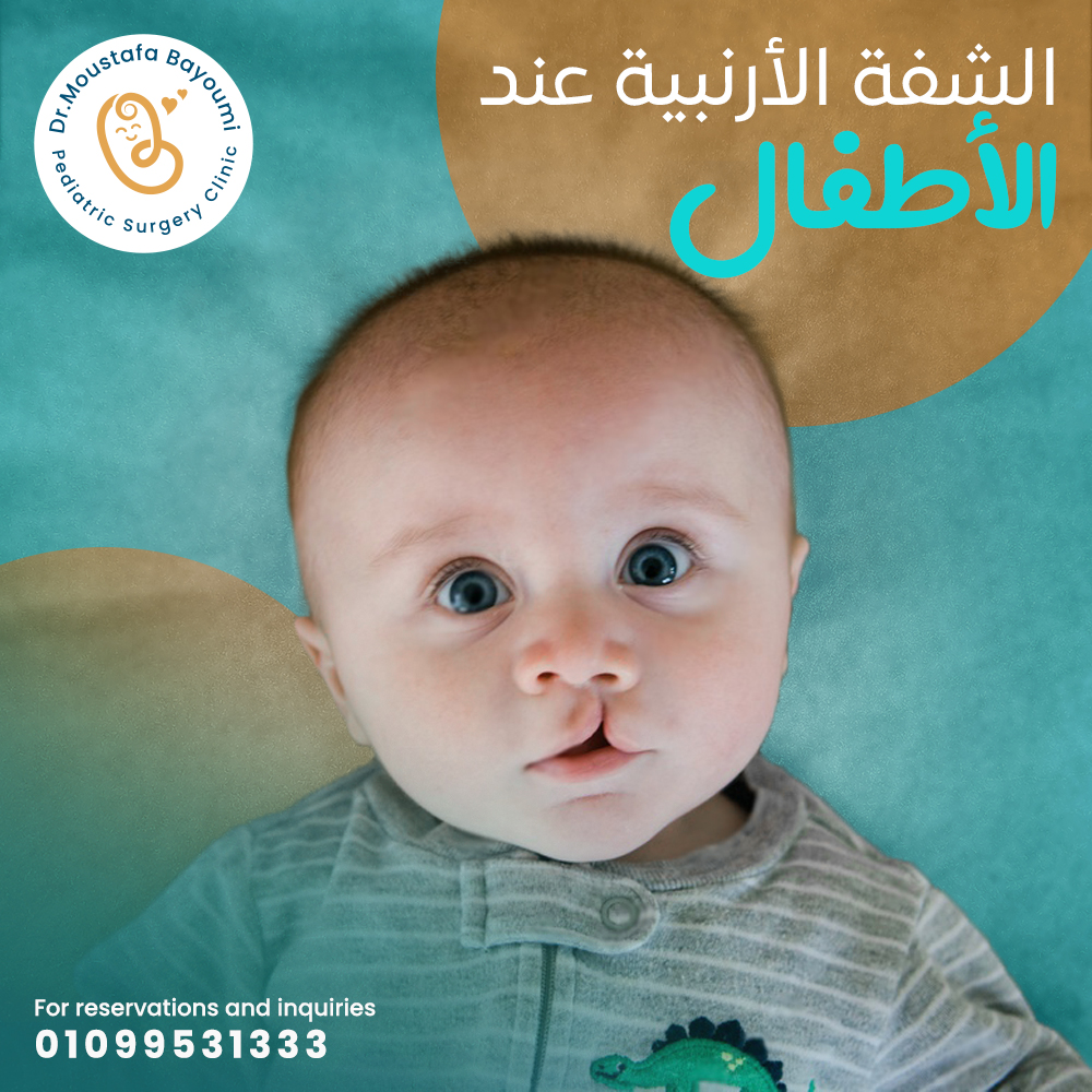 Pediatric Cleft Lip Surgery - Dr. Moustafa Bayoumi