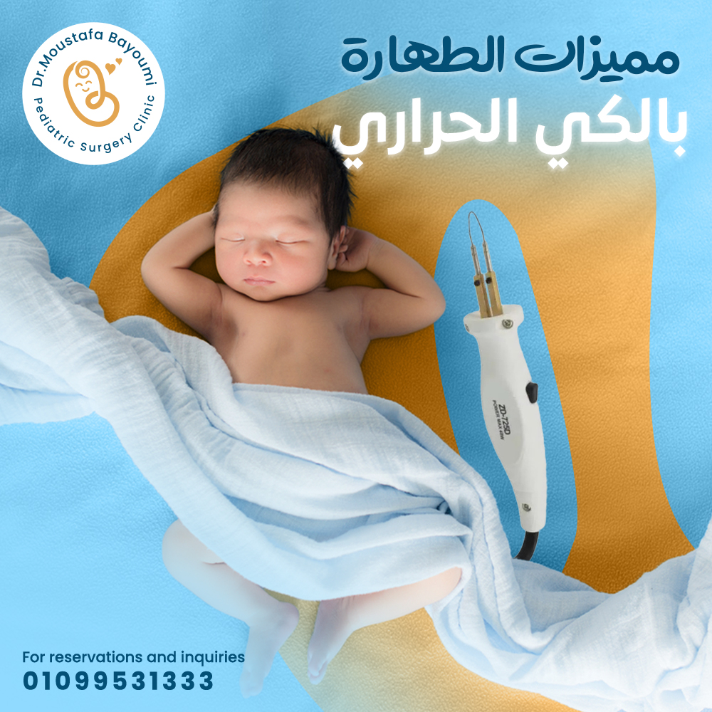 Circumcision Surgery - Dr. Moustafa Bayoumi