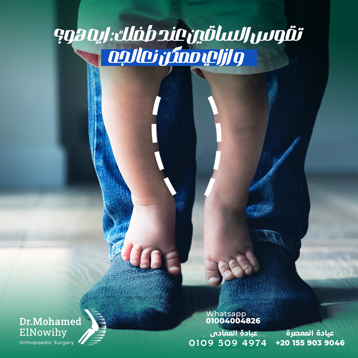 Bow Legs Correction - Dr. Mohamed ElNowihy